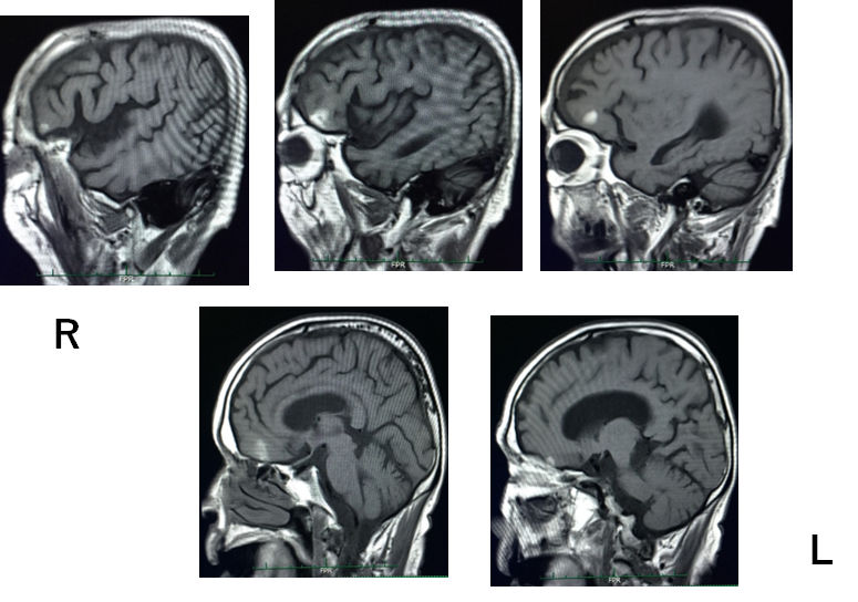 たなかクリニック　認知症